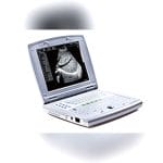 Portable Ultrasound System 1