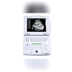 Portable Ultrasound System 2