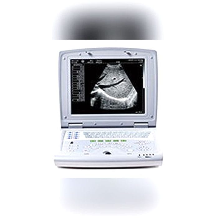 Portable Ultrasound System 3