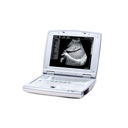 Portable Ultrasound System