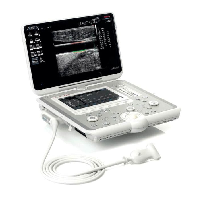 Portable Ultrasound System 1