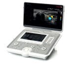 Portable Ultrasound System