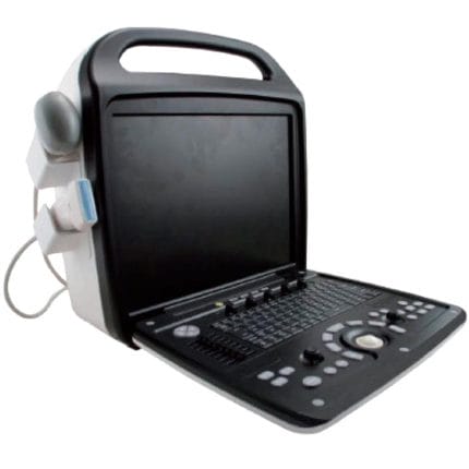 Portable Ultrasound System