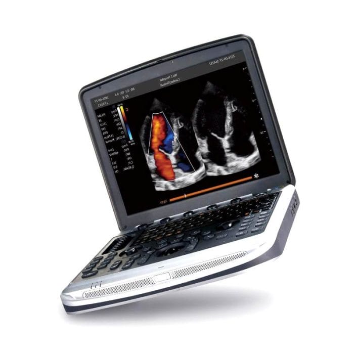 Portable Ultrasound System