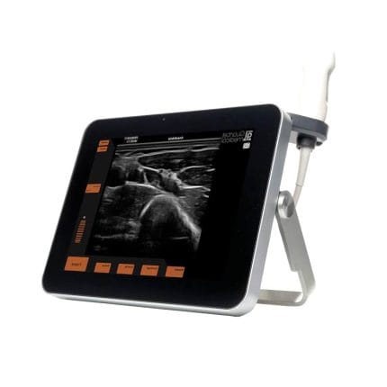 Portable Ultrasound System