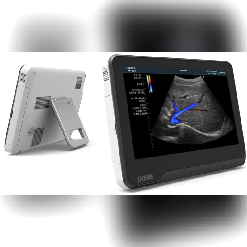 Portable Ultrasound System 1