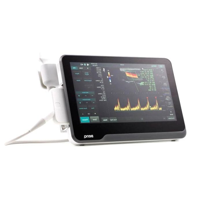 Portable Ultrasound System