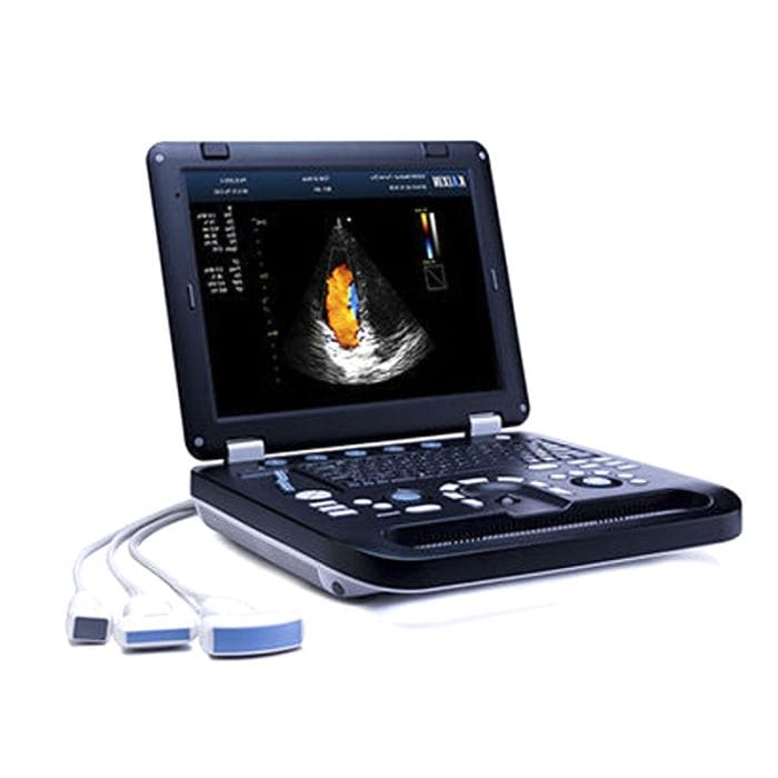 Portable Ultrasound System