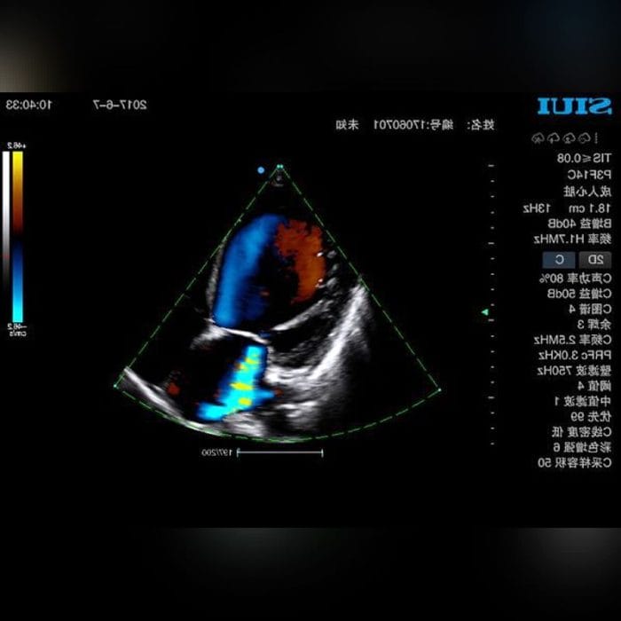 Portable Ultrasound System 5