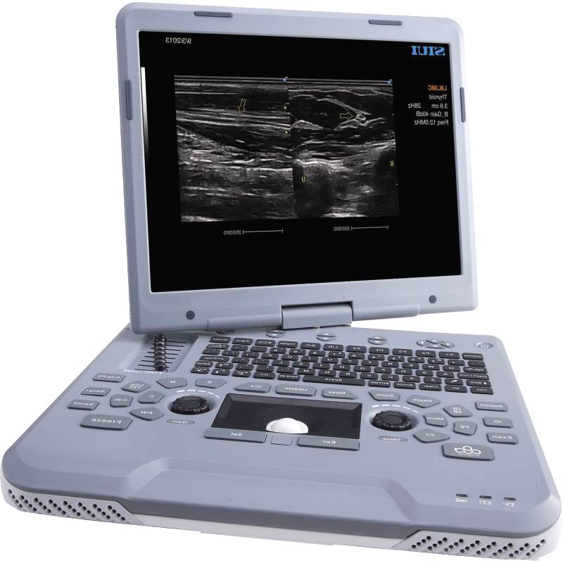 Portable Ultrasound System