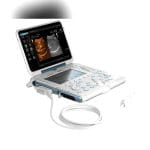 Portable Ultrasound System 3