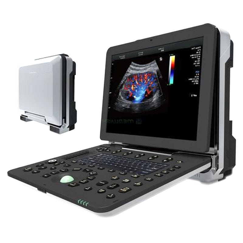 Portable Ultrasound System