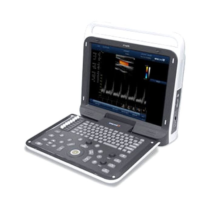 Portable Ultrasound System