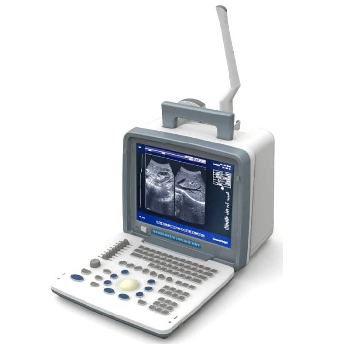 Portable Ultrasound System