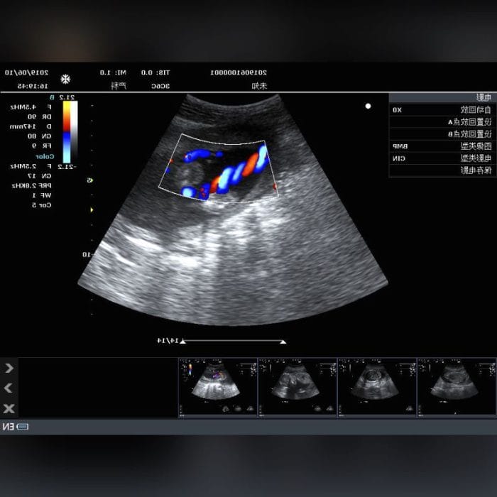 Portable Ultrasound System 3