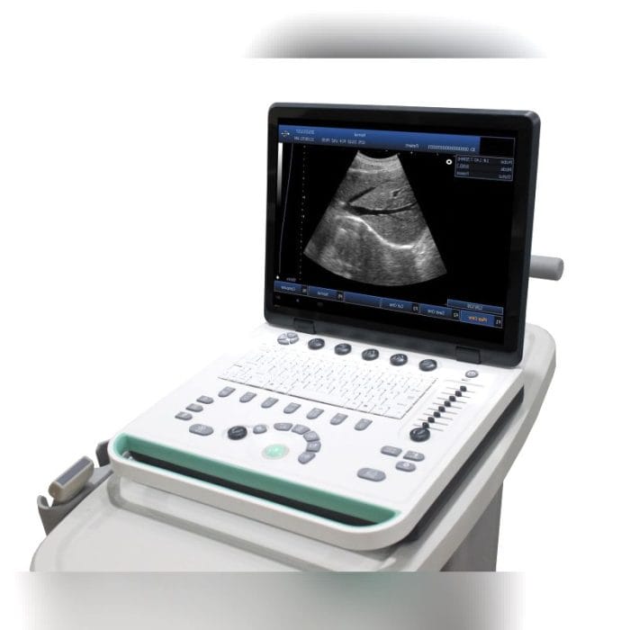 With Trolley Ultrasound System