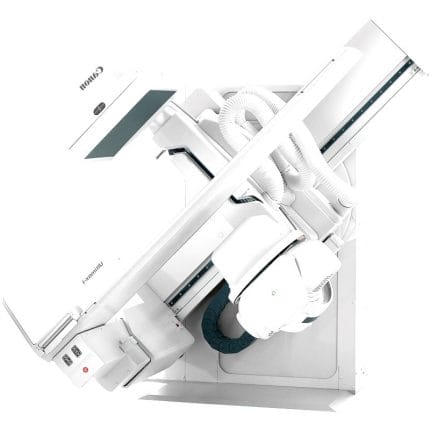 Radio-Fluoroscopy System