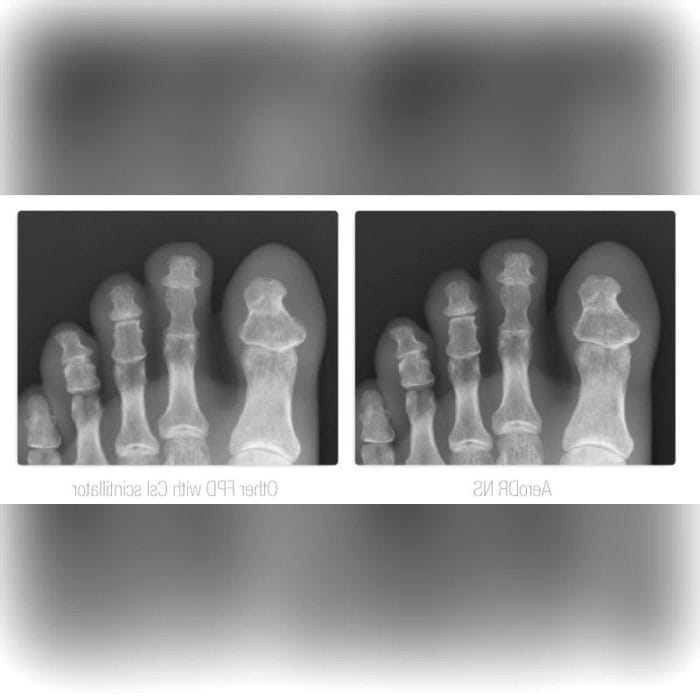 Radiography Acquisition System 4