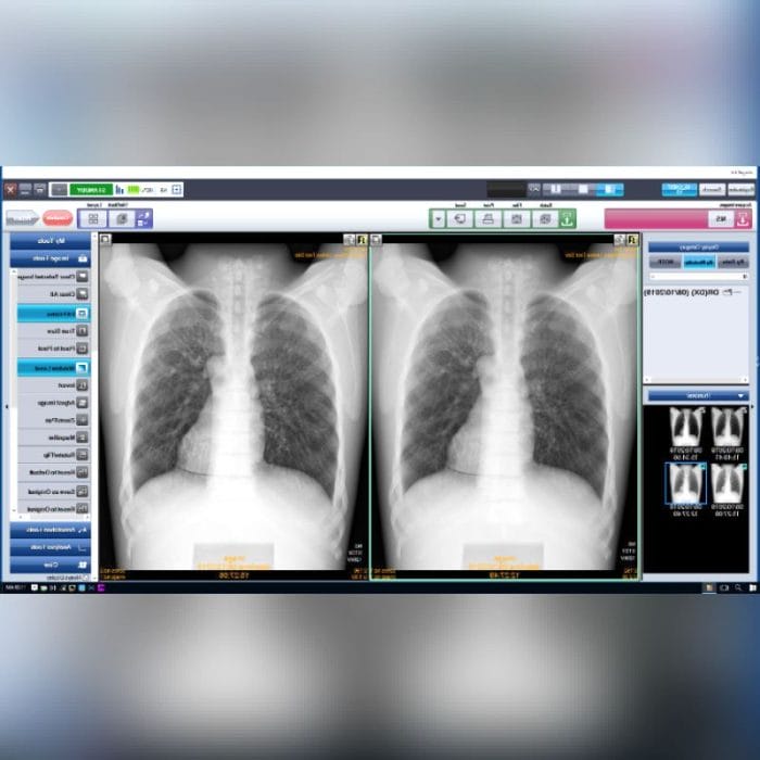 Radiography Acquisition System 5