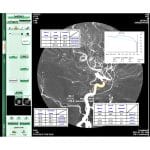 Radiography Acquisition System 2