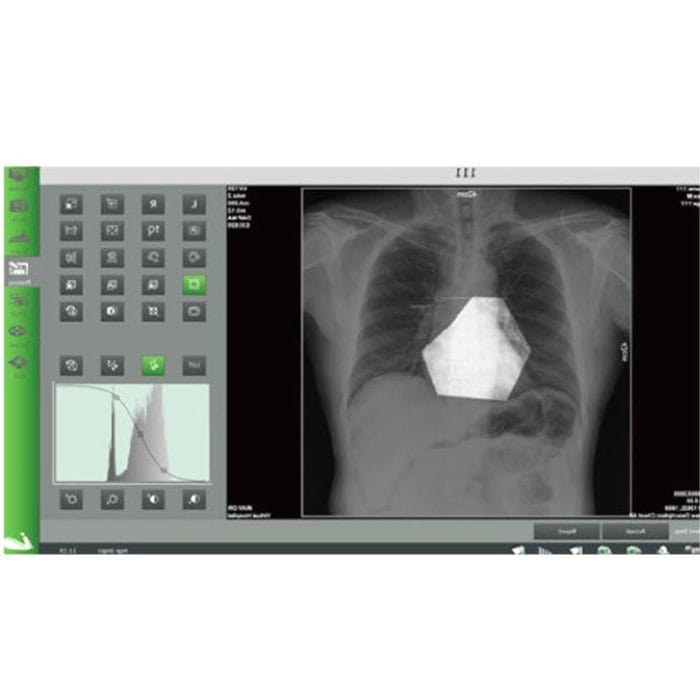 Radiography Acquisition System 4