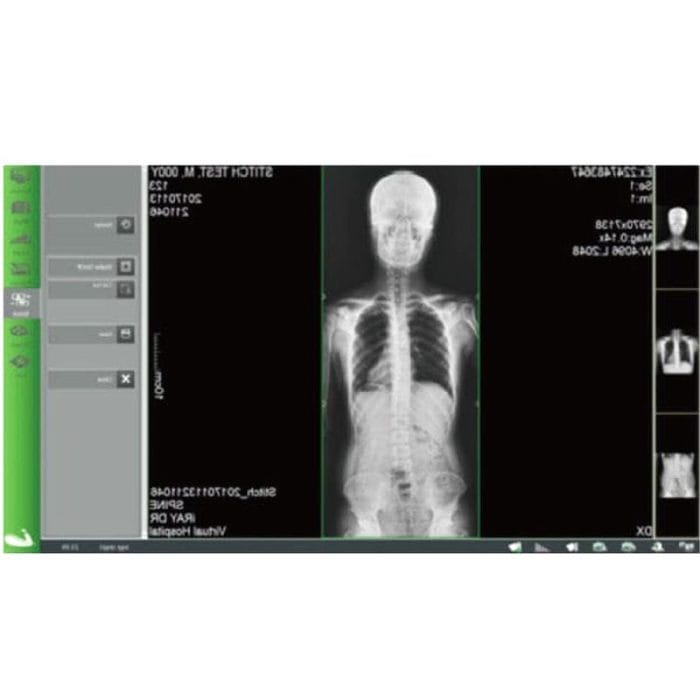 Radiography Acquisition System 5