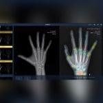 Radiography Software 1