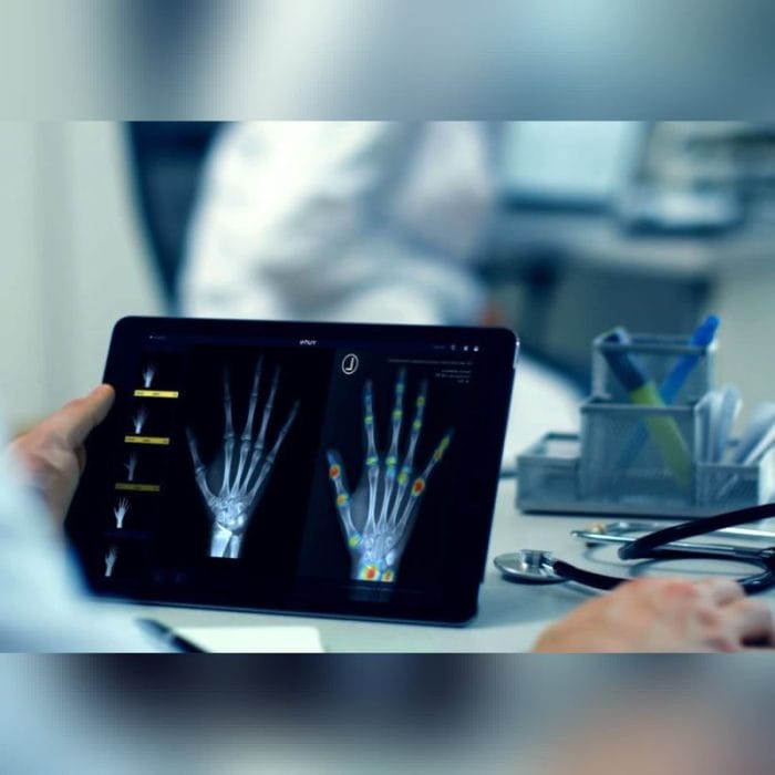 Radiography Software 2