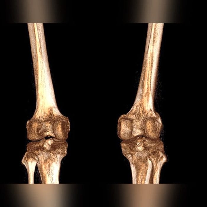 Radiography System 9