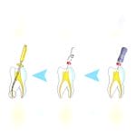 Reciprocating Endodontic File 4