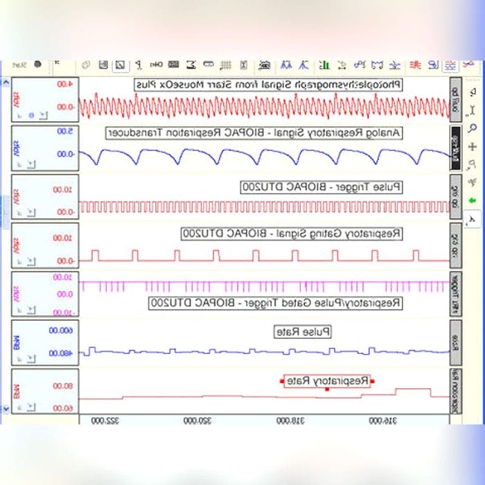 Respiratory Photoplethysmograph 3