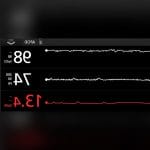 Respiratory Rate Patient Monitor 3