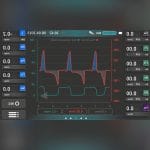 Respiratory Ventilator Tester 1