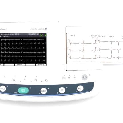 Resting Electrocardiograph 1