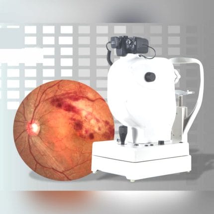 Retinal Camera 1