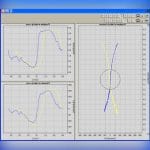 Rhinomanometer 2