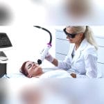 Scar Removal Laser 3