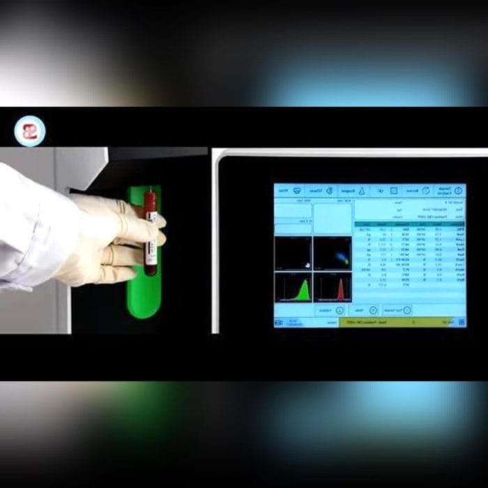 Semi-Automatic Protein Analyzer 1