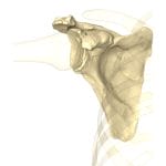 Shoulder Prosthesis Resection Guide 1