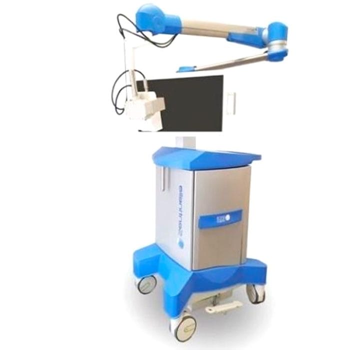 Single-Detector Gamma Camera