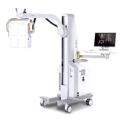 Single-Detector Gamma Camera