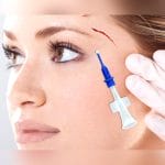 Skin Closure Surgery Tissue Adhesive 1