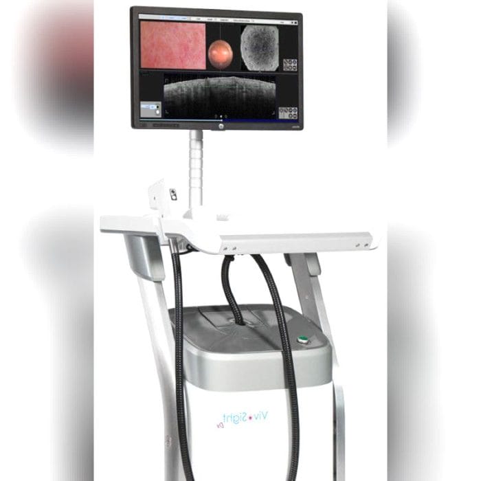 Skin Layer Oct Skin Analysis System 1