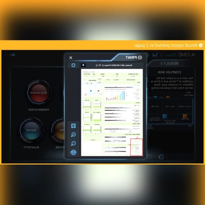 Skin Pigmentation Skin Analysis System 3