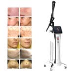 Skin Rejuvenation Laser 3