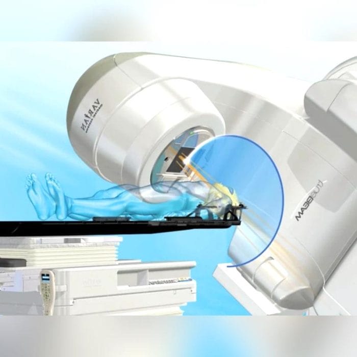 Stereotactic Radiosurgery Linear Particle Accelerator