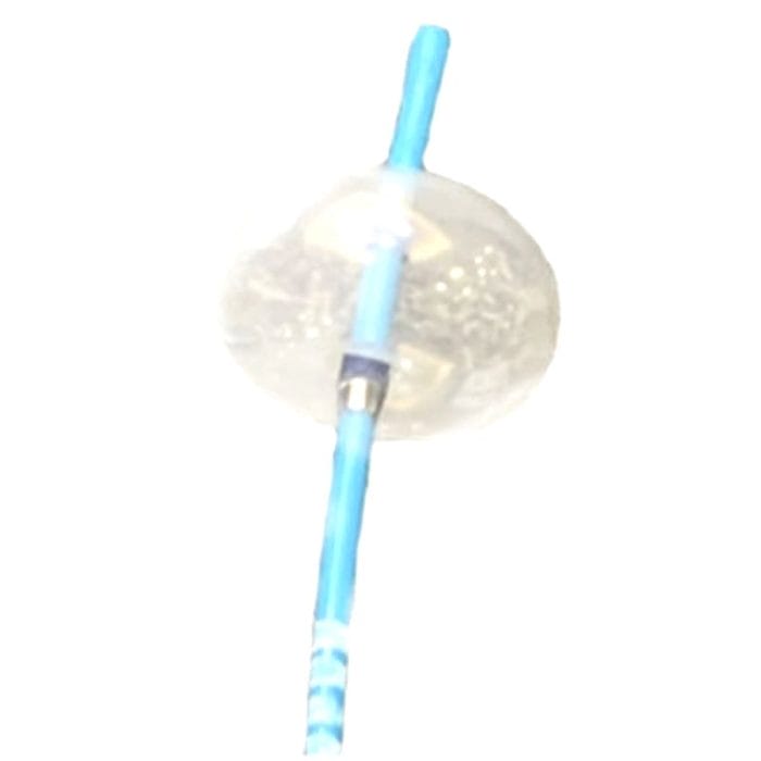 Stone Extraction Catheter 1