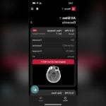 Stroke Diagnosis Mobile Application 2