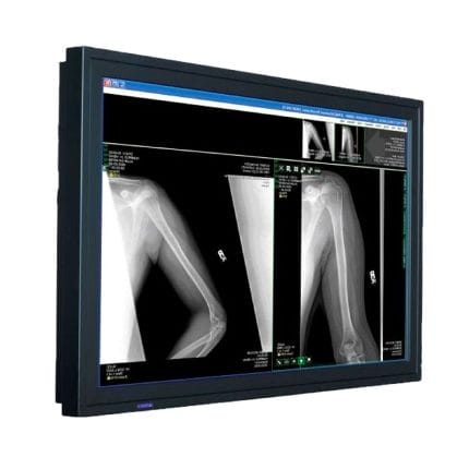 Surgical Display