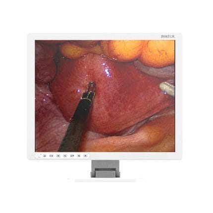 Surgical Display